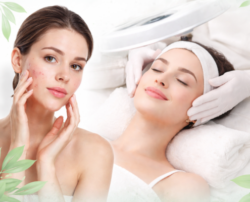 Frau mit Hautunreinheiten und Akne vor einer professionellen Gesichtsbehandlung im Kosmetikstudio